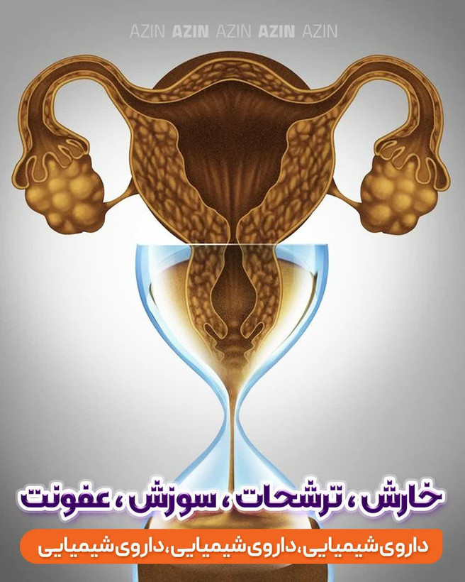 سوپر شیاف عالیییی آذین اصل اصل تضمینی
